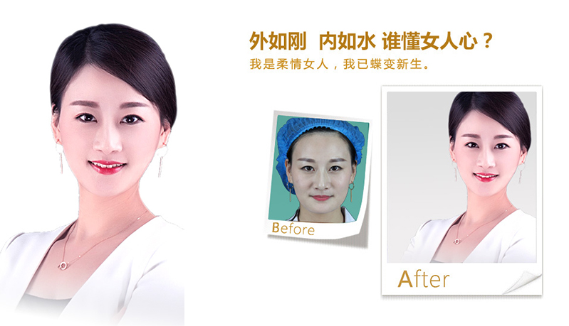 宁波V脸、线雕隆鼻